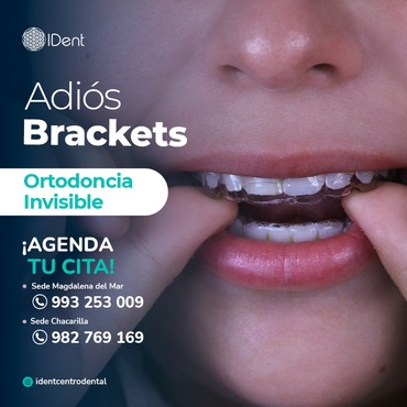 Ortodoncia Invisible