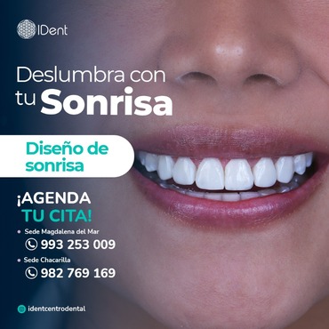 Diseño de Sonrisa